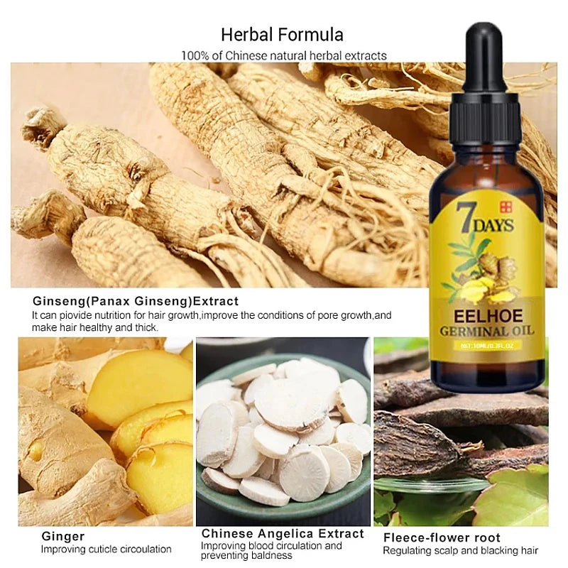 7 Days Ginger Hair Growth Products for Women Men Anti-loss Hair Treatment Hair Regrowth Oil Fast Regrowth Hair Spray Hair Care