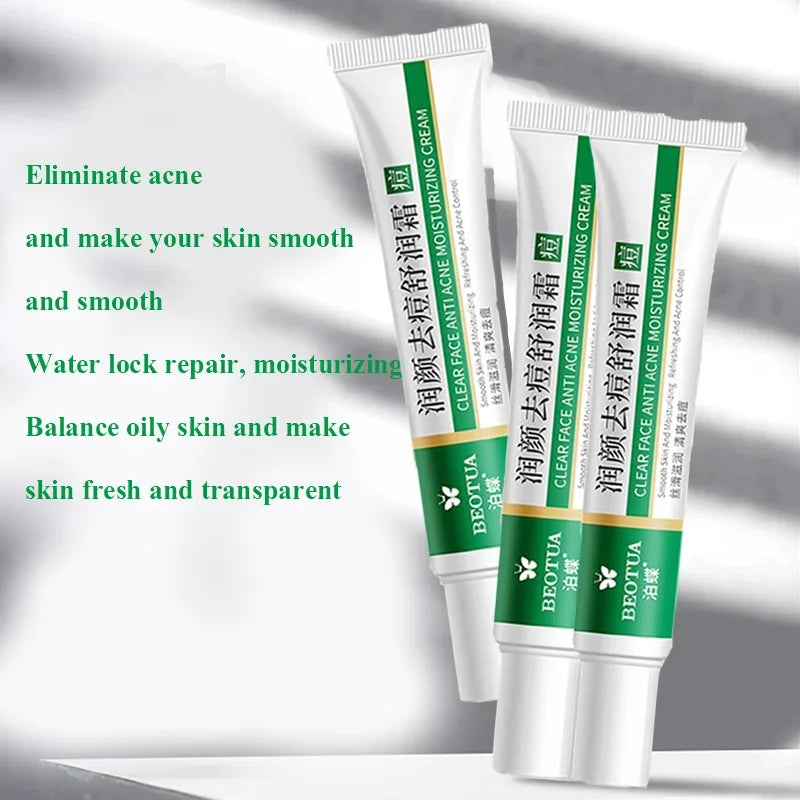 Herbal Acne & Blackhead Cream – Oil-Control, Pore-Refining Gel for Blemish-Prone Skin