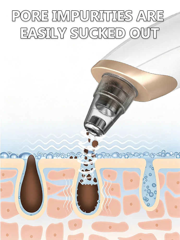 Blackhead Remover Pore Cleaner Black Dots Vacuum Cleaner Skin Pimple Acne Extractor Facial Cleaning Electric Black Head Removal.