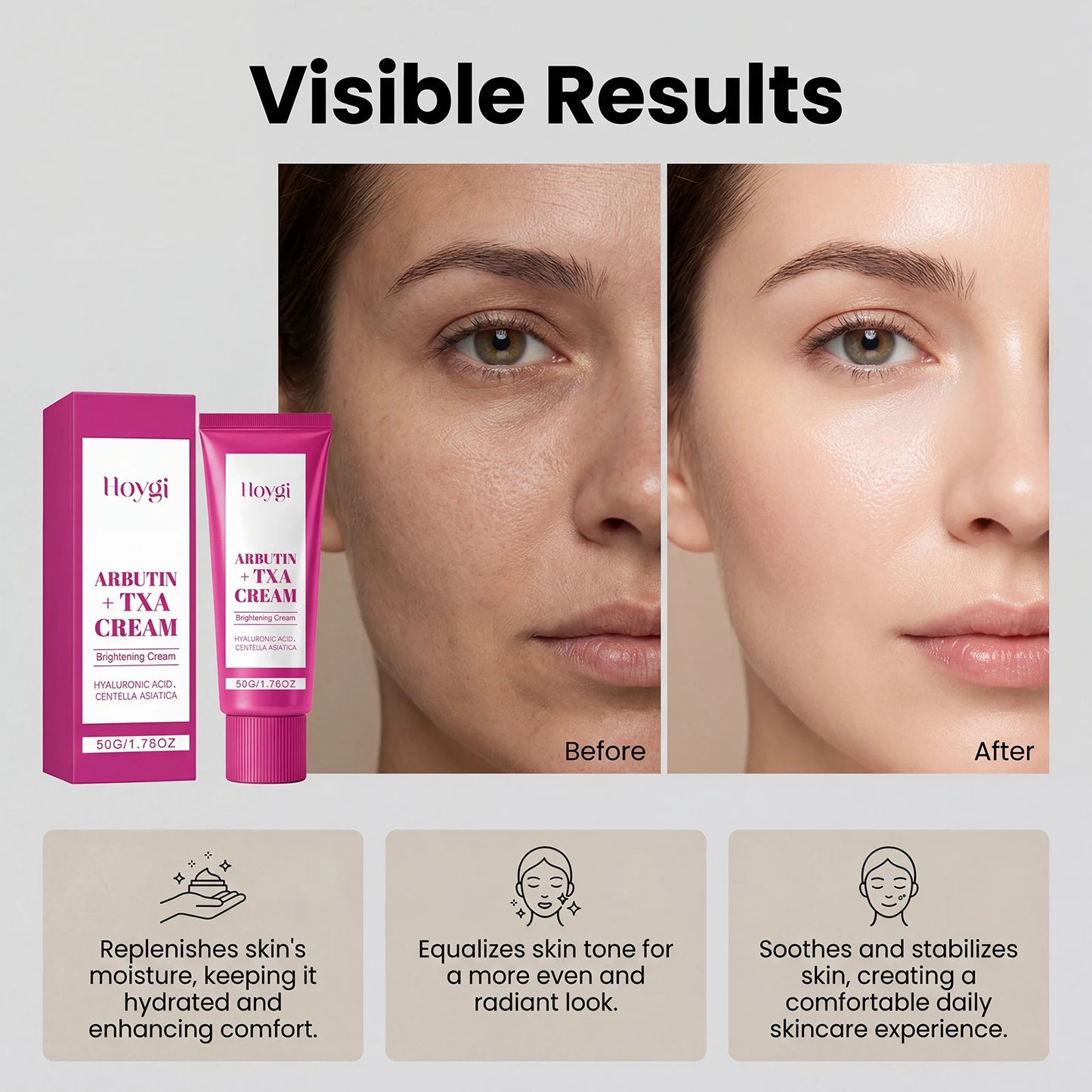 Relief Cream Face Moisturizer Cream Nourish Soothing Skin Repair Clean Acne For Oily Skin, Hydrating Facial Lotion Skincare
