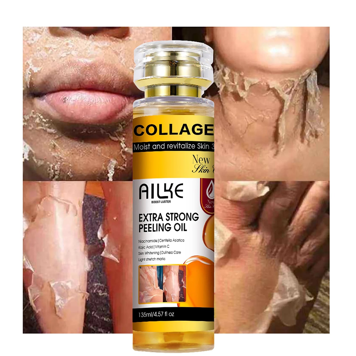 AILKE Collagen & Kojic Acid Peeling Oil 135ml – Whitening, Exfoliating & Brightening for Face, Body, Hands & Feet | All Skin Types