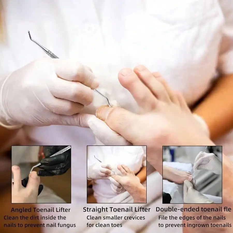 3pcs Nail Stain Removal Tool, Multifunctional Nail File, Pedicure Tool Beauty File, Ingrown Toenail Tool Pedicure Nail Cleaner