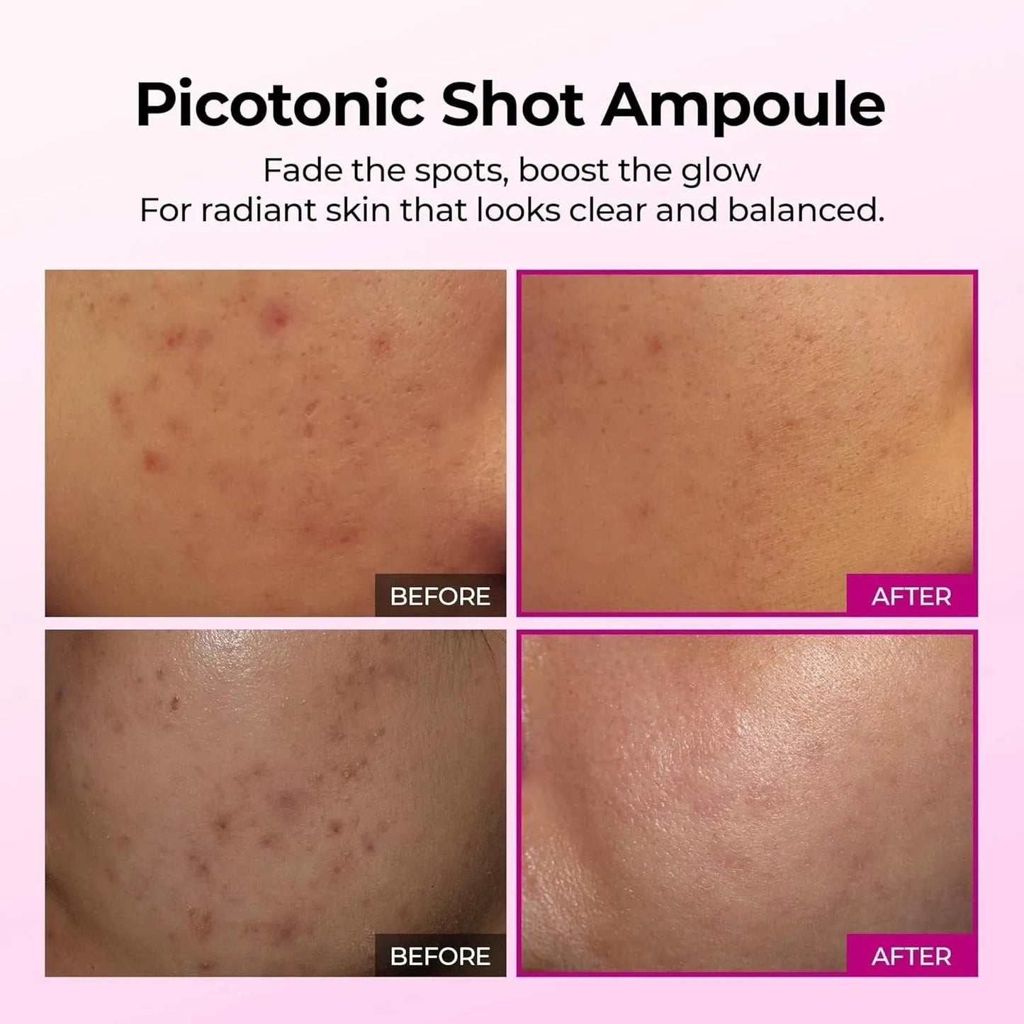 Picotonic Shot Serum with Alpha Firming Density Serum for Even Skin Tone, Anti-Aging & Dark Spot Care, 1.01 fl.oz