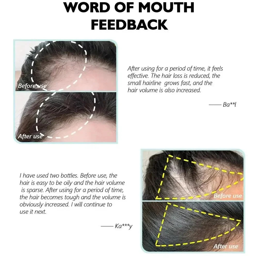 Batana Oil Hair Growth Serum Spray Repair Hair Nourish Root Regrowth Hair Anti Hair Loss Essence Men Women Hair Care Products