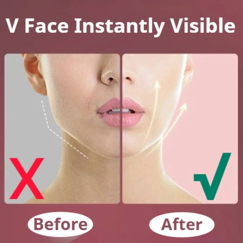 Facial Lifting V Face Massager Red Light Therapy Micro Vibration Slimming Device Double Chin Nasolabial Folds Massager Facial