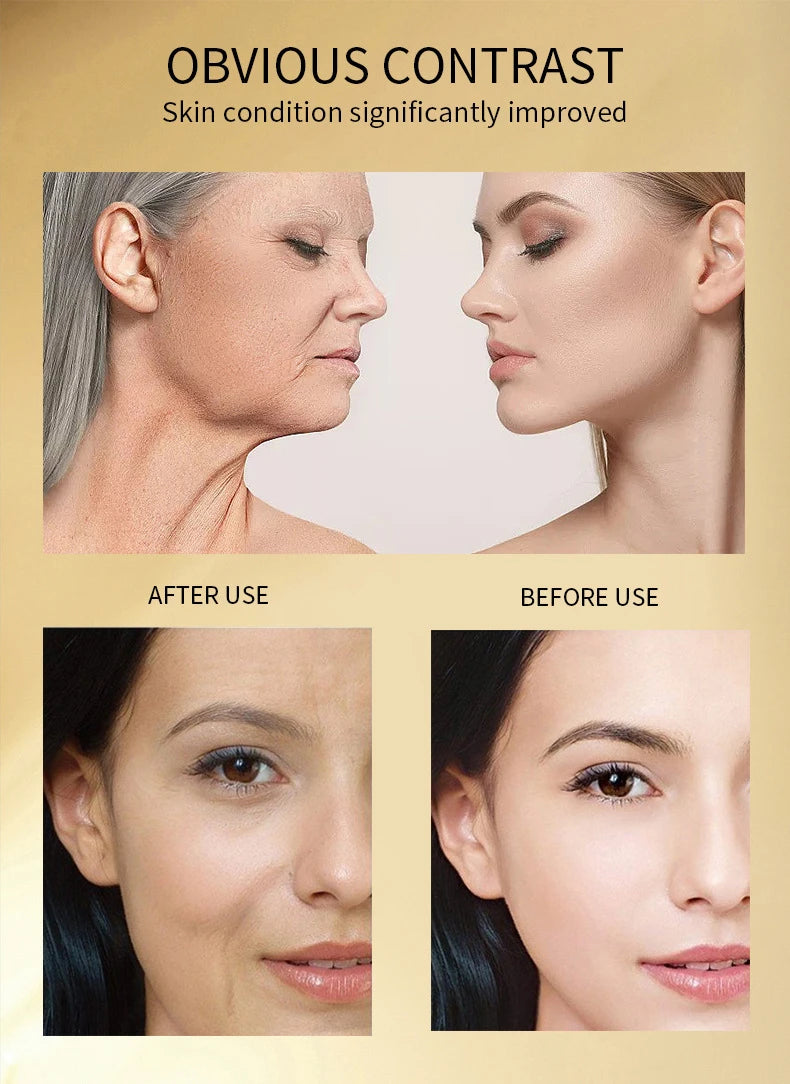 24K Gold Hyaluronic Acid Nicotinamide Face Serum Moisturize Softening The Skin, Preventing Dryness and Cracking Facial Essence
