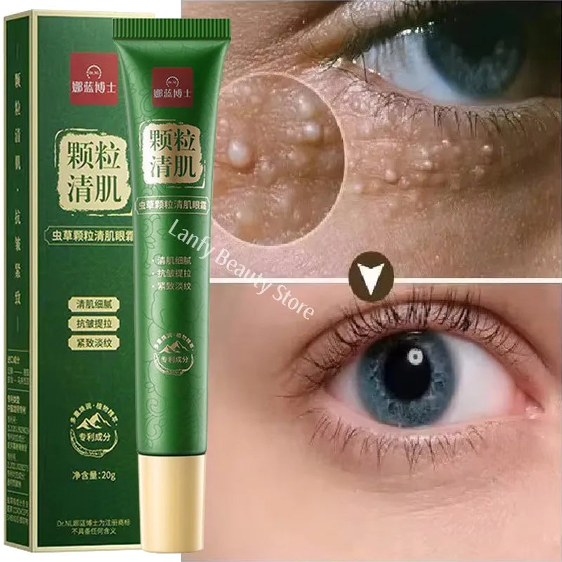 Fat Granules Remover Eye Cream Anti-Puffiness Anti Inflammatory Reduce Dark Circles Eyebags Fade Lines Moisturizing Eye Care