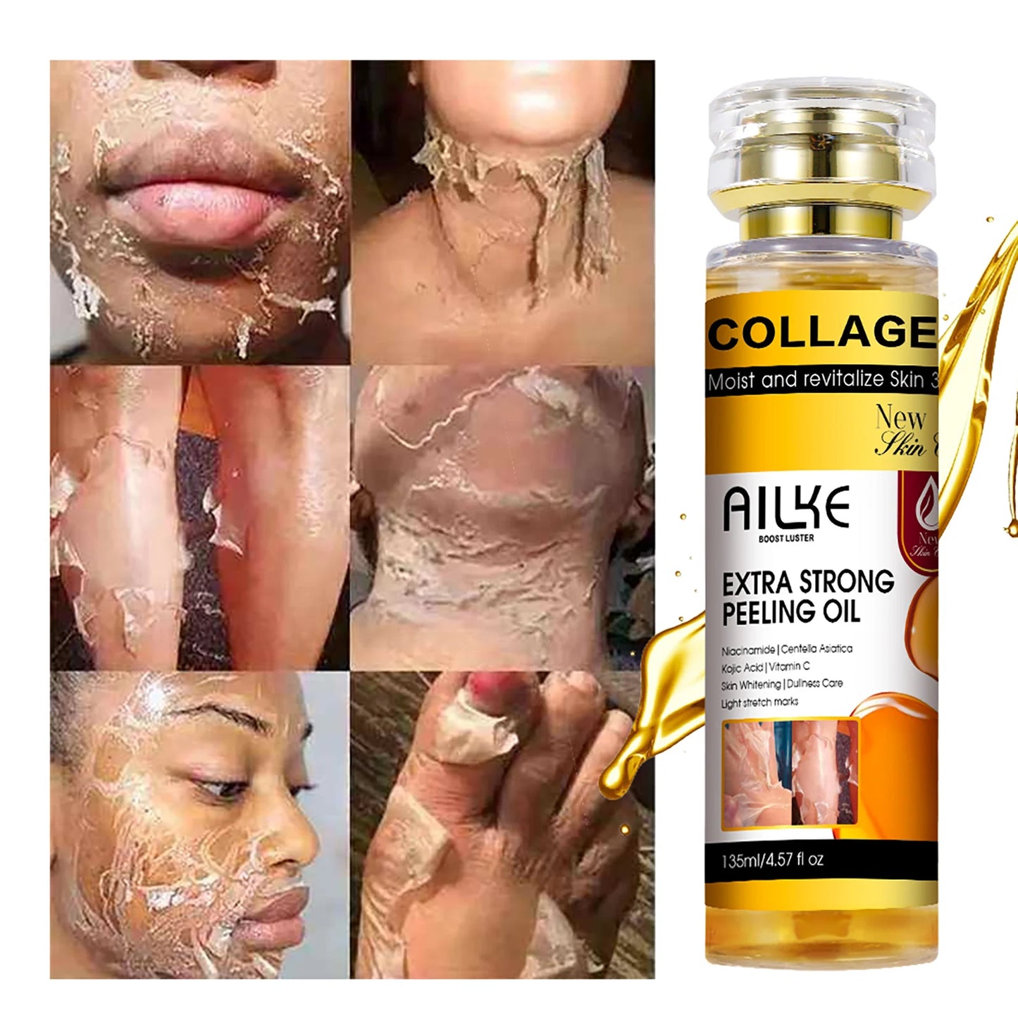 AILKE Collagen & Kojic Acid Peeling Oil 135ml – Whitening, Exfoliating & Brightening for Face, Body, Hands & Feet | All Skin Types