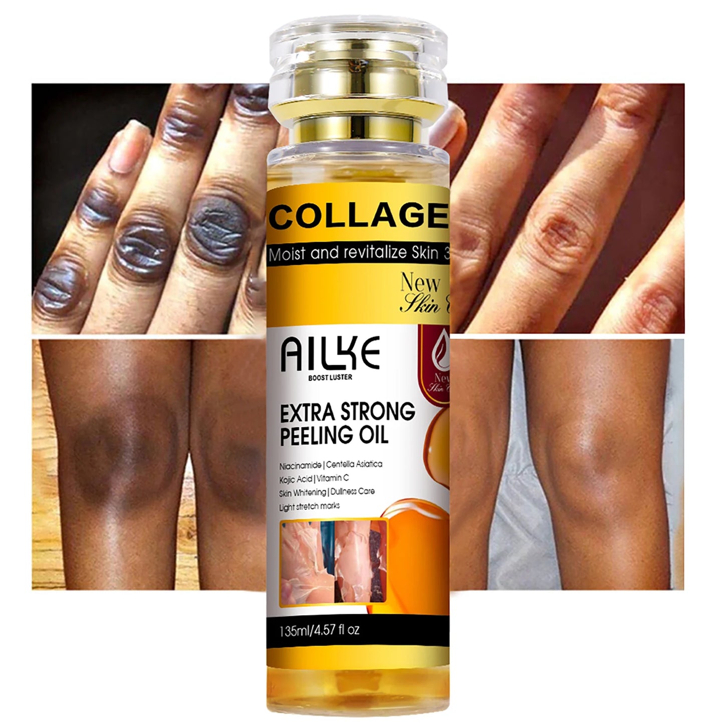 AILKE Collagen & Kojic Acid Peeling Oil 135ml – Whitening, Exfoliating & Brightening for Face, Body, Hands & Feet | All Skin Types