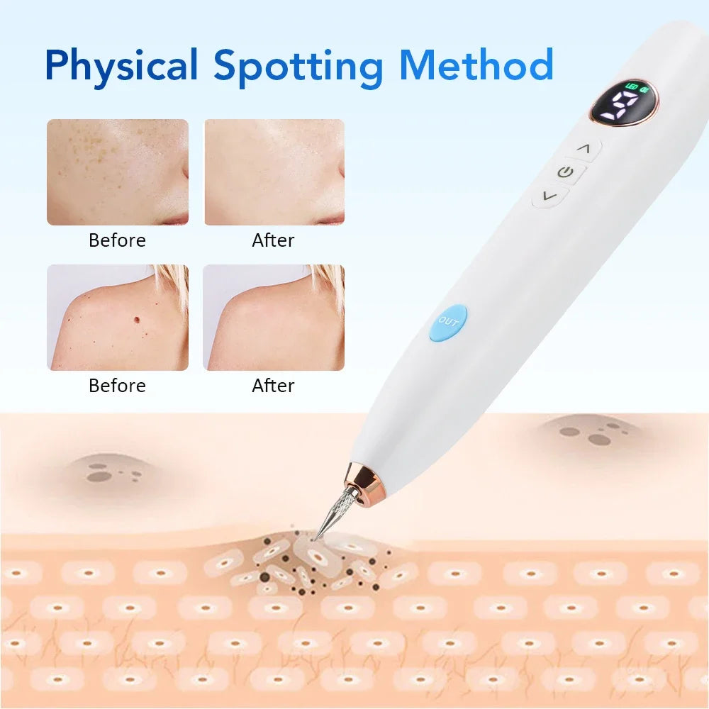 Laser Tattoo Mole Removal Pen 9 Modes LCD Plasma Pen Skin Care Tools Tag Removal Freckle Wart Dark Spot Remover Beauty Care Tool
