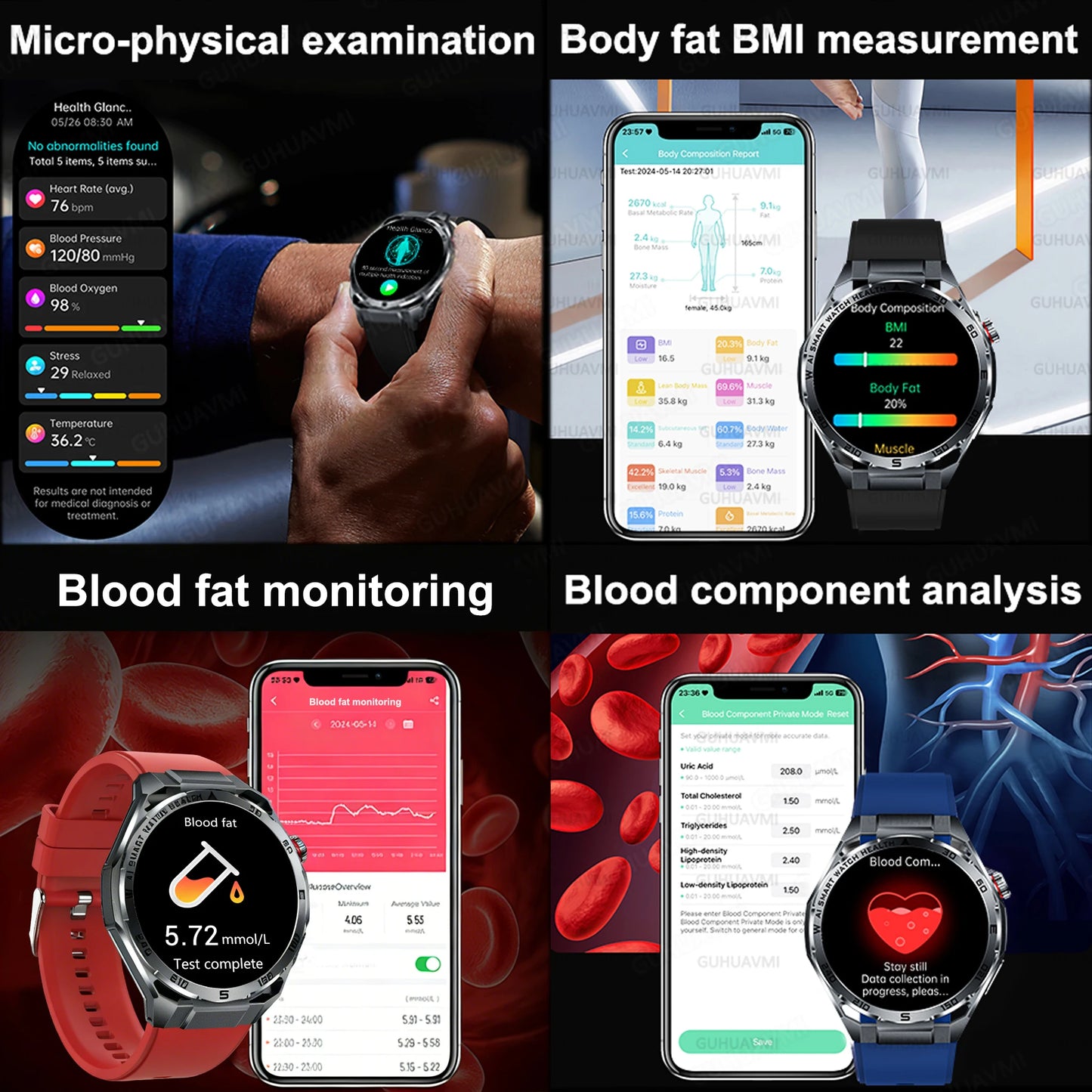 2026 New Body Fat AI Analysis Health Smart Watch ECG+PPG Uric Acid BP Blood Oxygen Call AMOLED Screen Smart Watch For Men Women