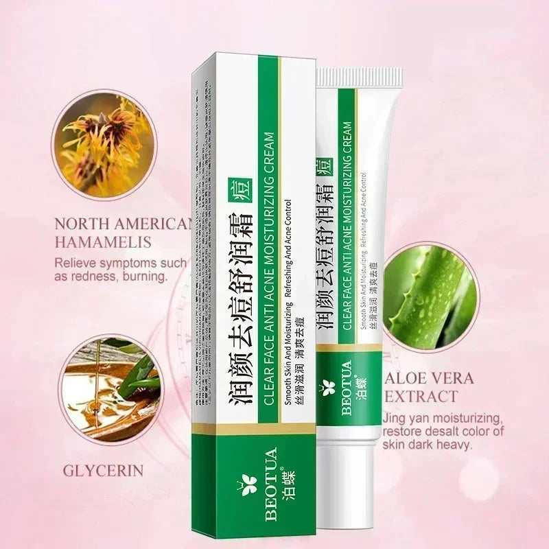 Herbal Acne & Blackhead Cream – Oil-Control, Pore-Refining Gel for Blemish-Prone Skin