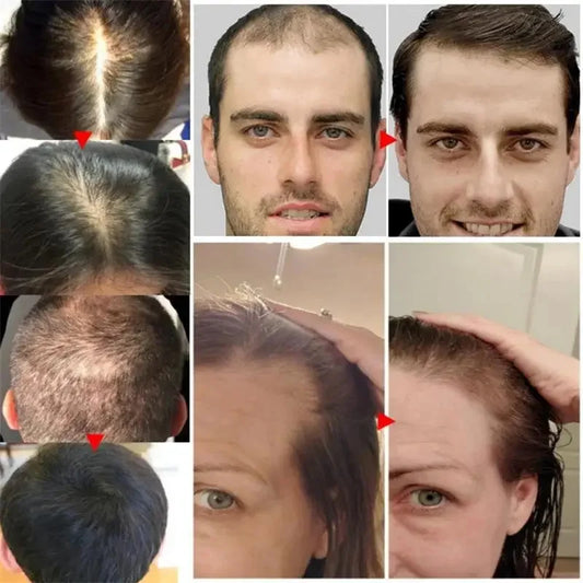 Batana Oil Hair & Scalp Serum – Nourishing Care for Dry, Damaged Hair | Women & Men