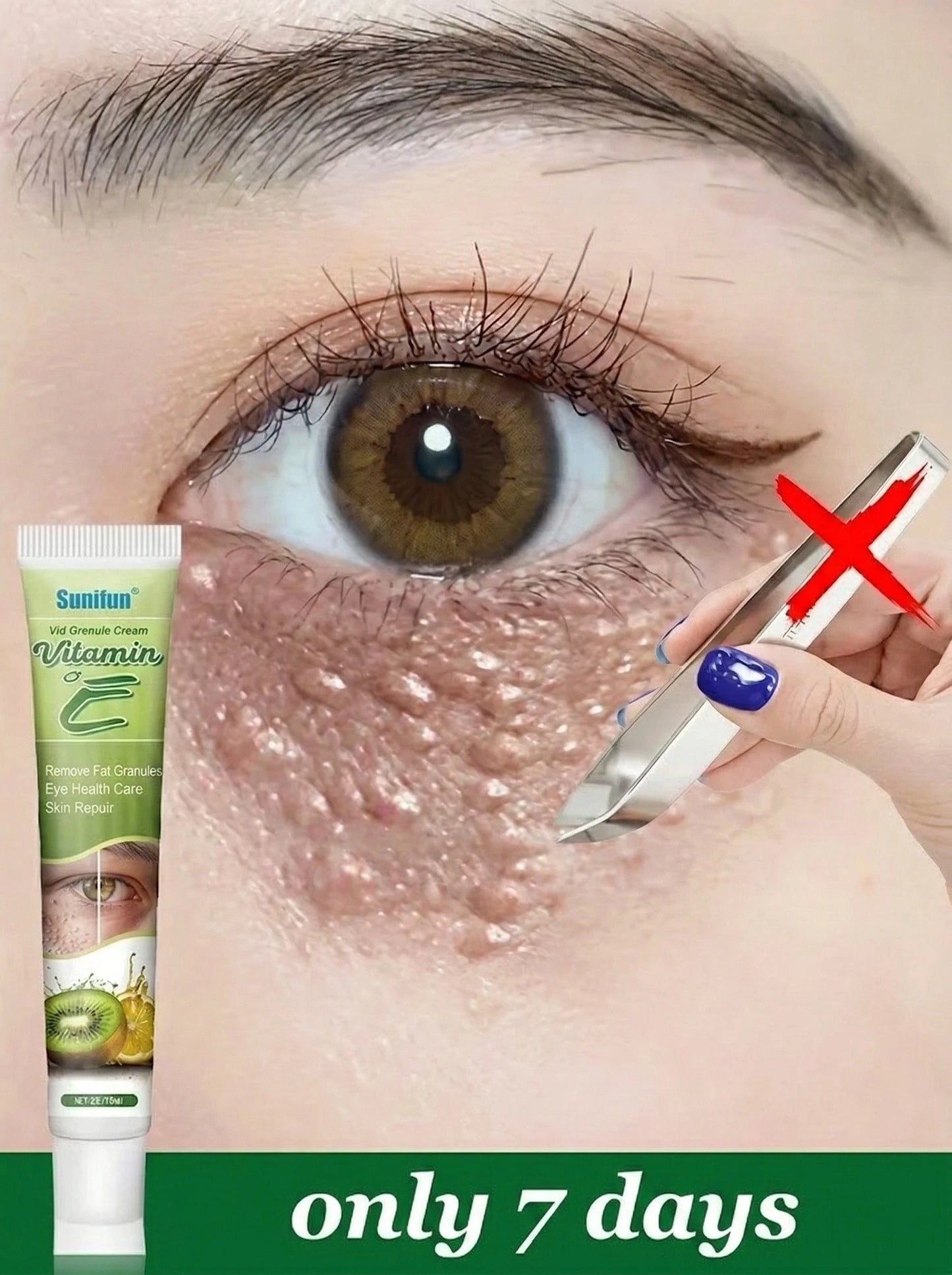 Fat Granules Remover Eye Cream Skin Care Products