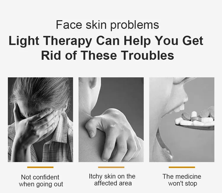 311NM  UVB Narrow Band UV Light Source Treatment Vitiligo Psoriasis Eczema Therapy Lamp Ultraviolet Phototherapy Instrument