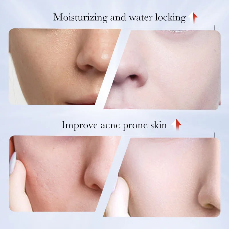 Kojic Acid Facial Cleanser Face Wash Foam Facial Cleansing Mossee Moisturizing Brightening Shrink Pores Facial Skincare Products