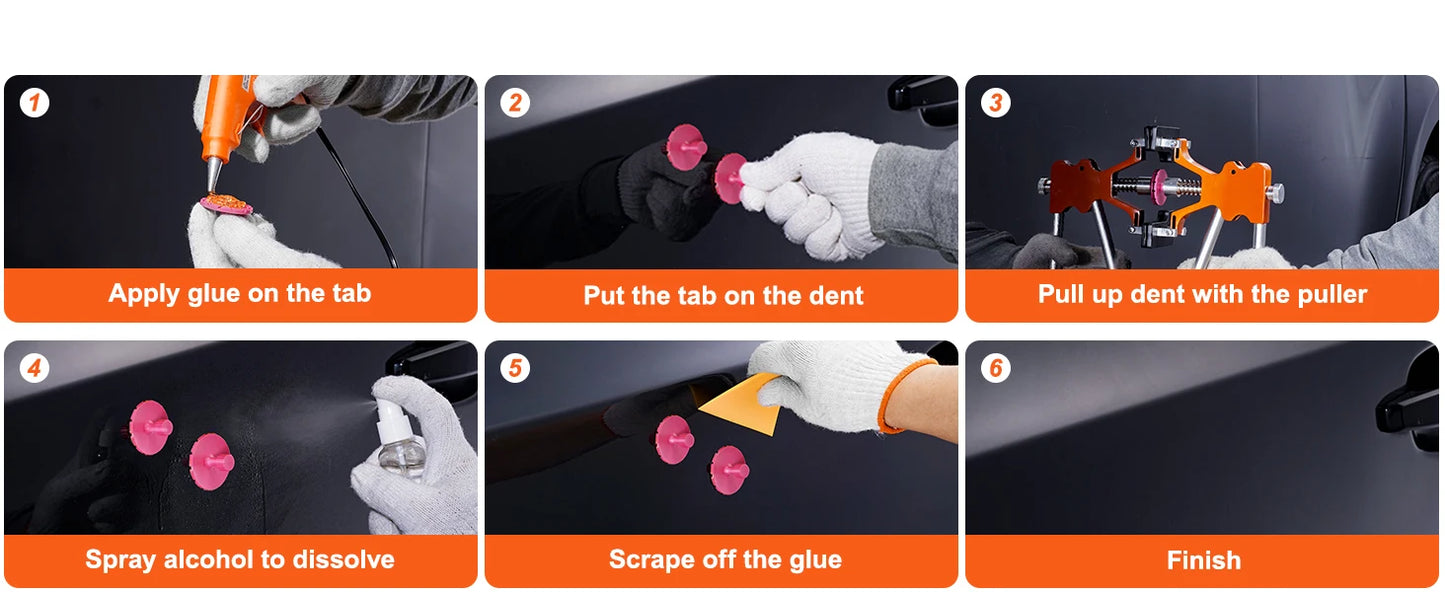 SucceBuy 107 PCS Dent Removal Kit, Paintless Dent Repair Kit Suction Cup Dent Puller for Auto Body Dents, Hail Damage, Door Ding
