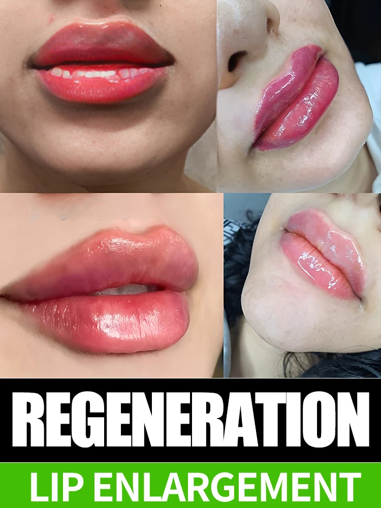 100% lip augmentation in one month