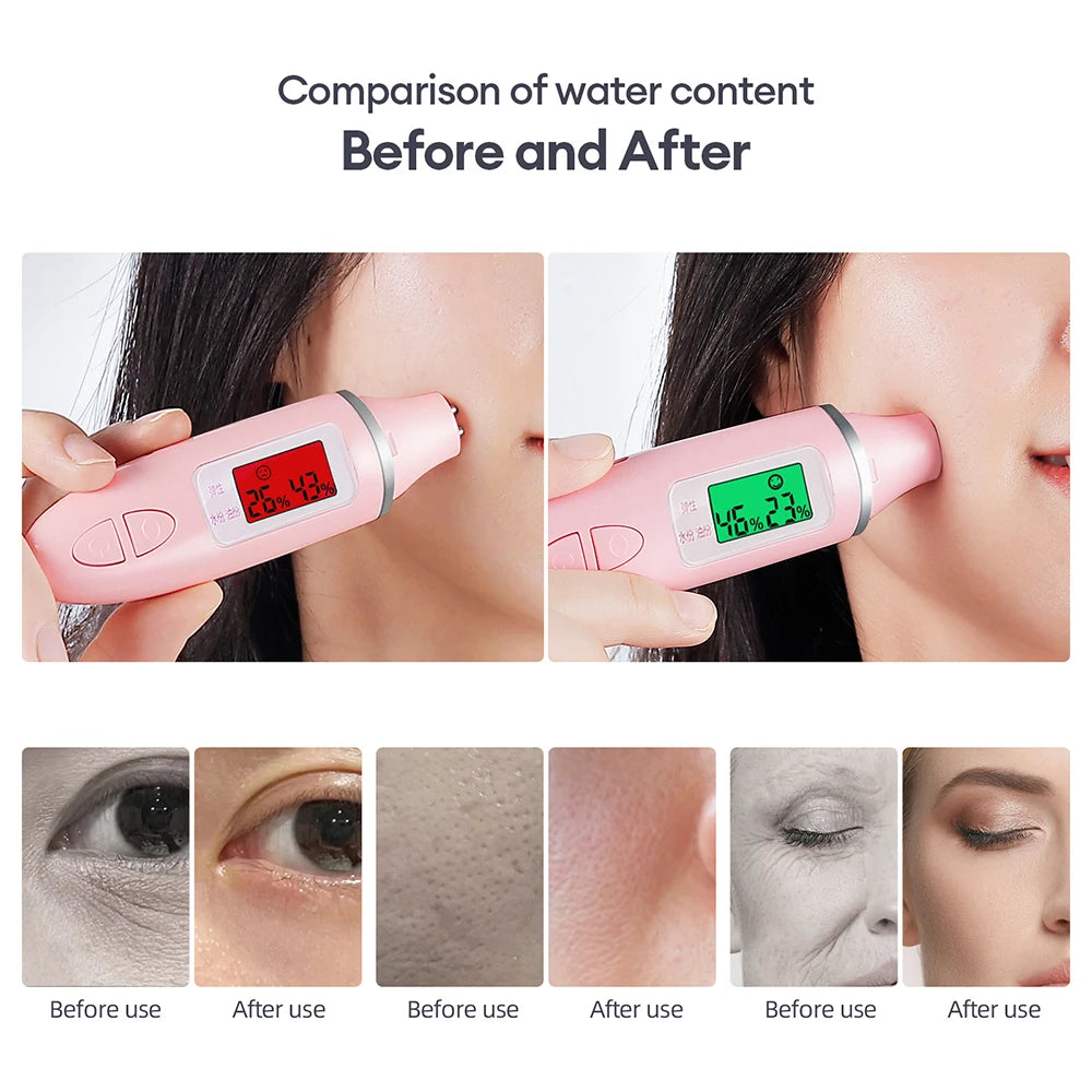 CO2 Oxygen Bubble Pen 5 Gear Vibration Oxygen Bubble Beauty Tool Deep Cleansing Pores Exfoliate LED Photon Skin Care Machine