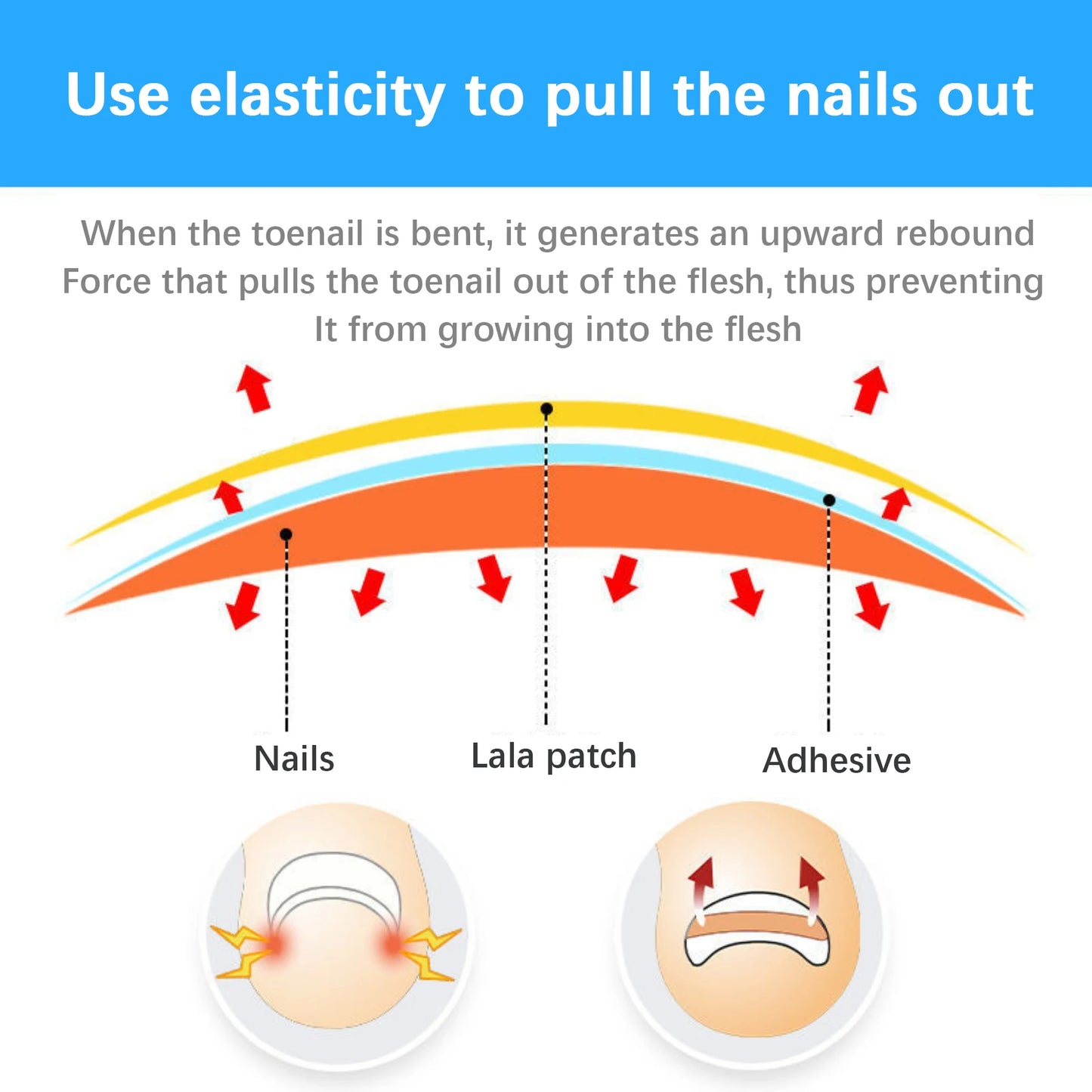 50Pcs Ingrown Toenail Correction Tool Ingrown Toe Nail Treatment Elastic Patch Sticker Straightening Clip Brace Pedicure Tool