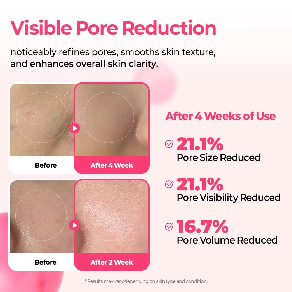 Cyano Pink Spicule Serum with Vitamin B12, Liquid Microneedle Pore Refining Face Essence, Niacinamide for Skin Texture Renewal,