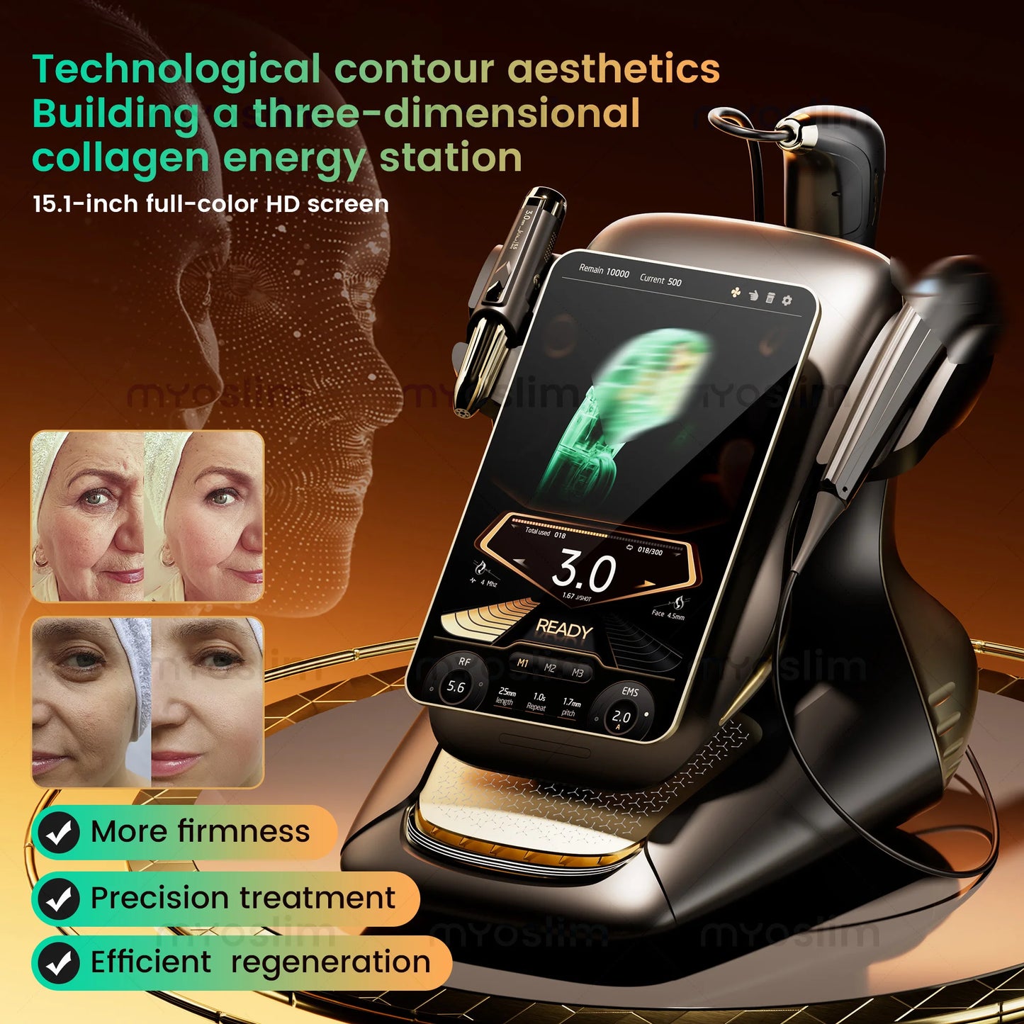 Portable RF Lift Machine — Facial & Body Skin Firming Device