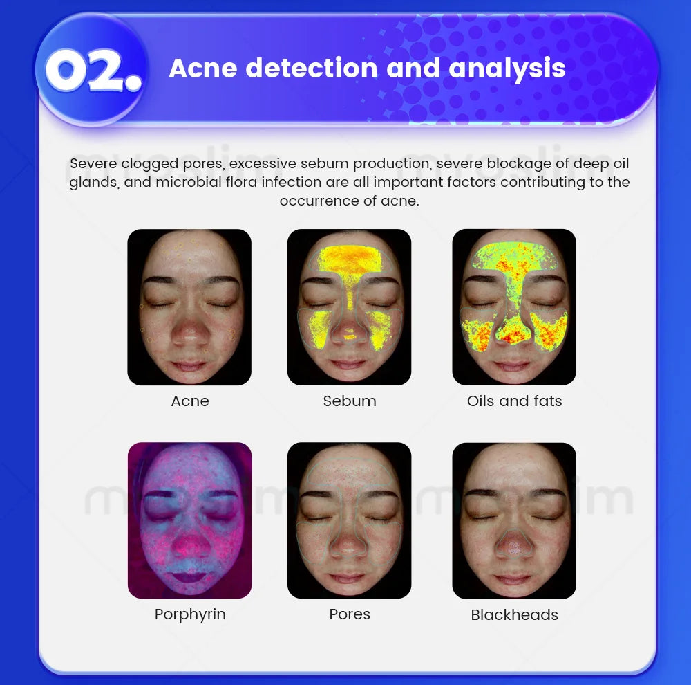 21.5 Inch 3D Facial Skin Analyzer Machine AI 8 Light Spectrum Skin Care Scanner for Business Hair Analysis Beauty Care
