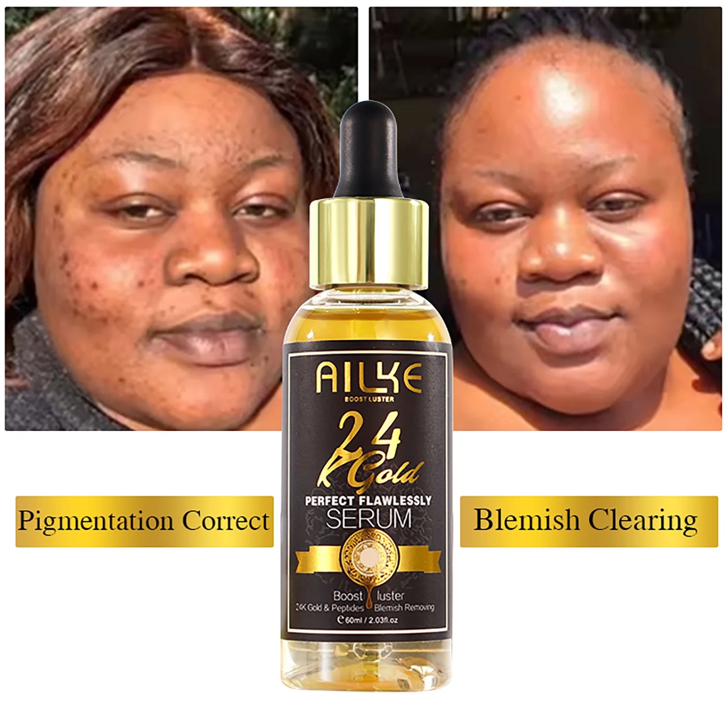 AILKE 24K Glod Flawlessly Skin Care Set, Whitening, Reduce Dark Spots, Pigmentation, Wrinkles, Moisturize, For All Skin Types