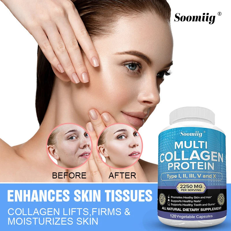 SOOMIIG Multi-Collagen Peptides Capsules – Types I II III V X | Hair, Skin, Nails, Joints & Gut Health | Gluten Free, Non-GMO | 30/60/120 Count