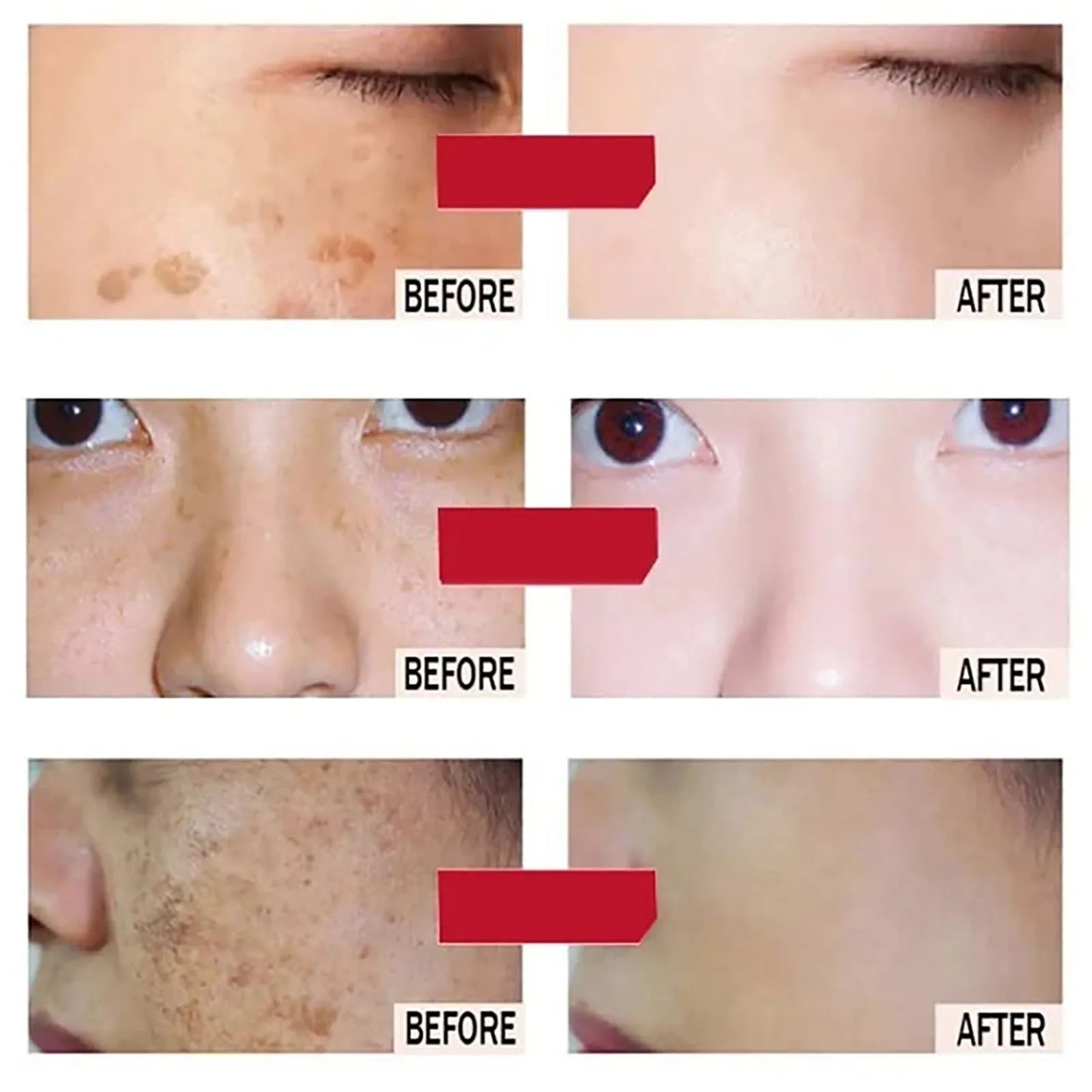 AILKE Whitening Face Cream, Reduce Dark Spots, Sun Spots, Melanin, With Collagen, Glutathione, Even Skin Tone For All Skin Types