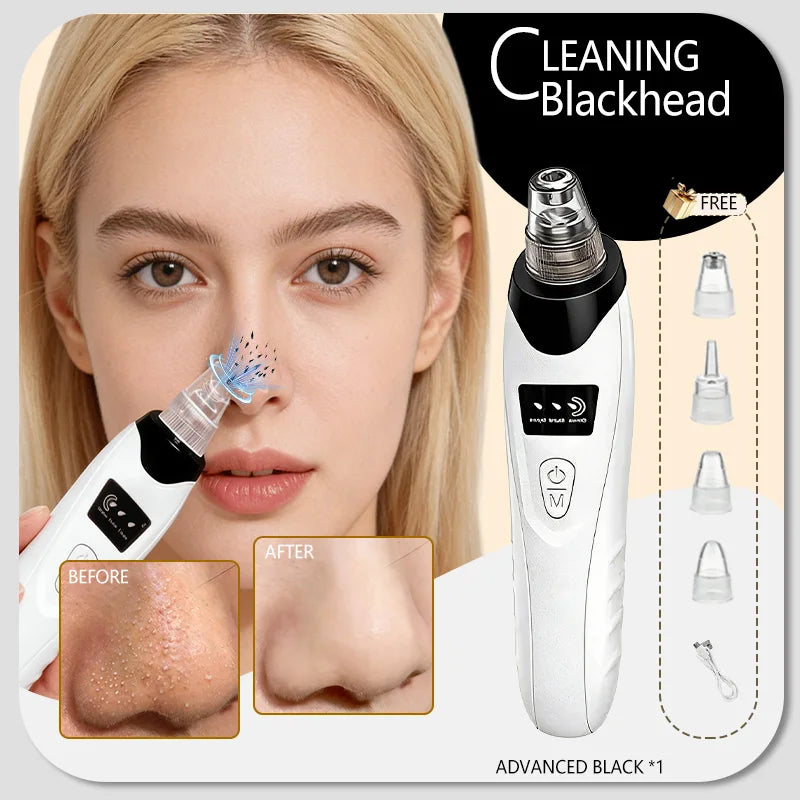 Electric Blackhead Remover Vacuum – Pore Cleaner & Acne Extractor | Facial Deep Cleaning Tool