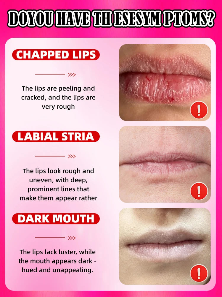 100% lip augmentation in one month