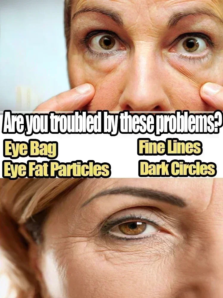 Hot sales Eye Fine Lines Dark Circles Eye Cream Remove Eye Bags Puffiness Way Work Under Eyes Lightening Moisturizing Whitening