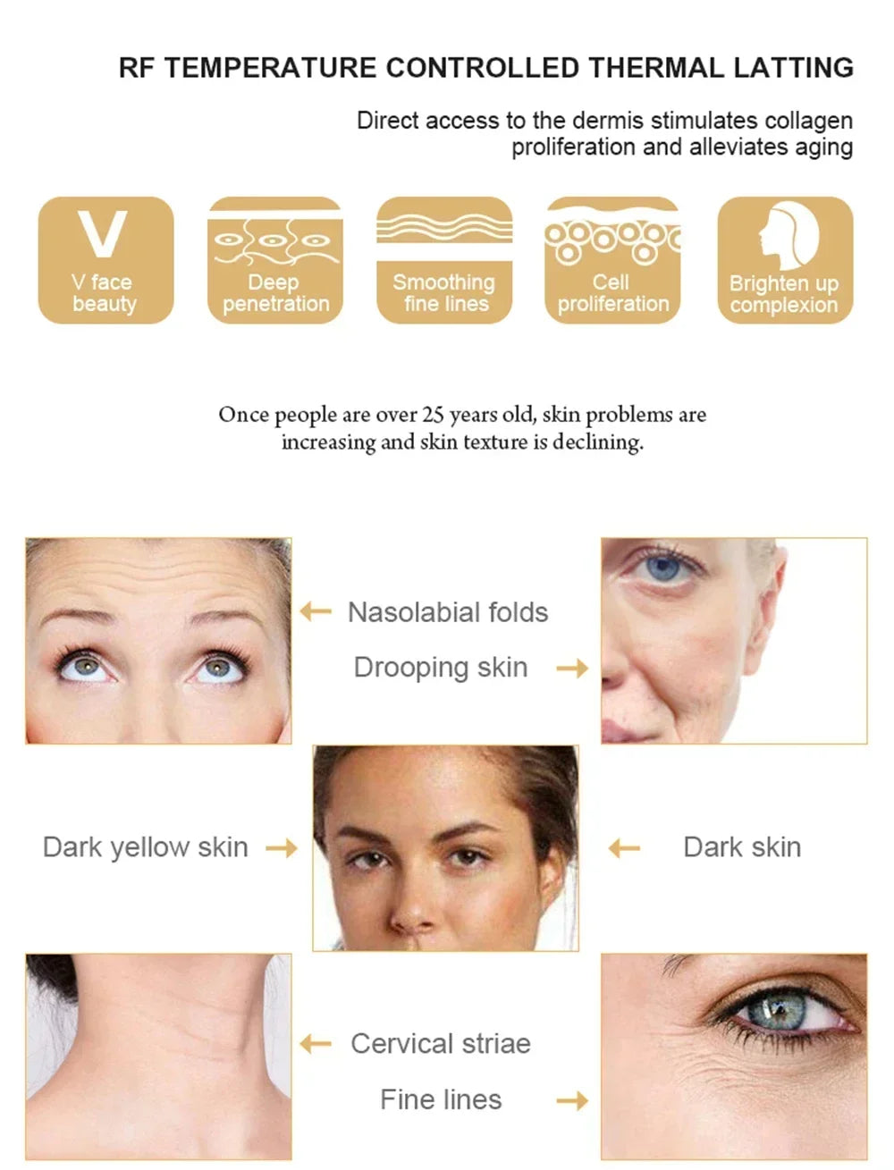 RF Radio Frequency Face Lifting Device Dot Matrix Beauty Massager Home Wrinkle Remover Skin Tightening Facial Massage Machine, women