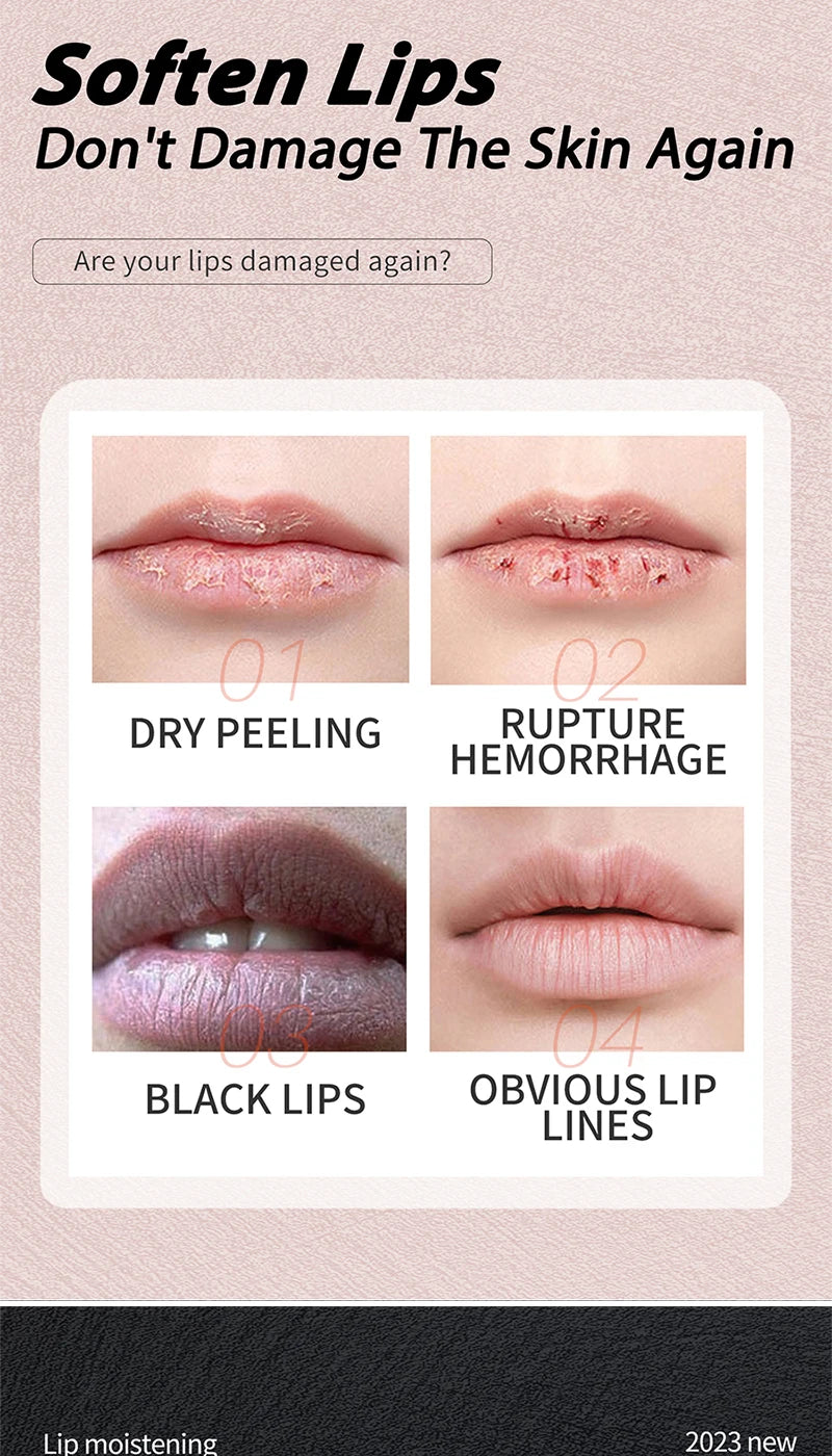 Lip Balm Remove Dark Lips Eliminate Dark Marks - Smooth Lip Lines Prevent Dryness Remove Black Pigment Lip Care Treatment
