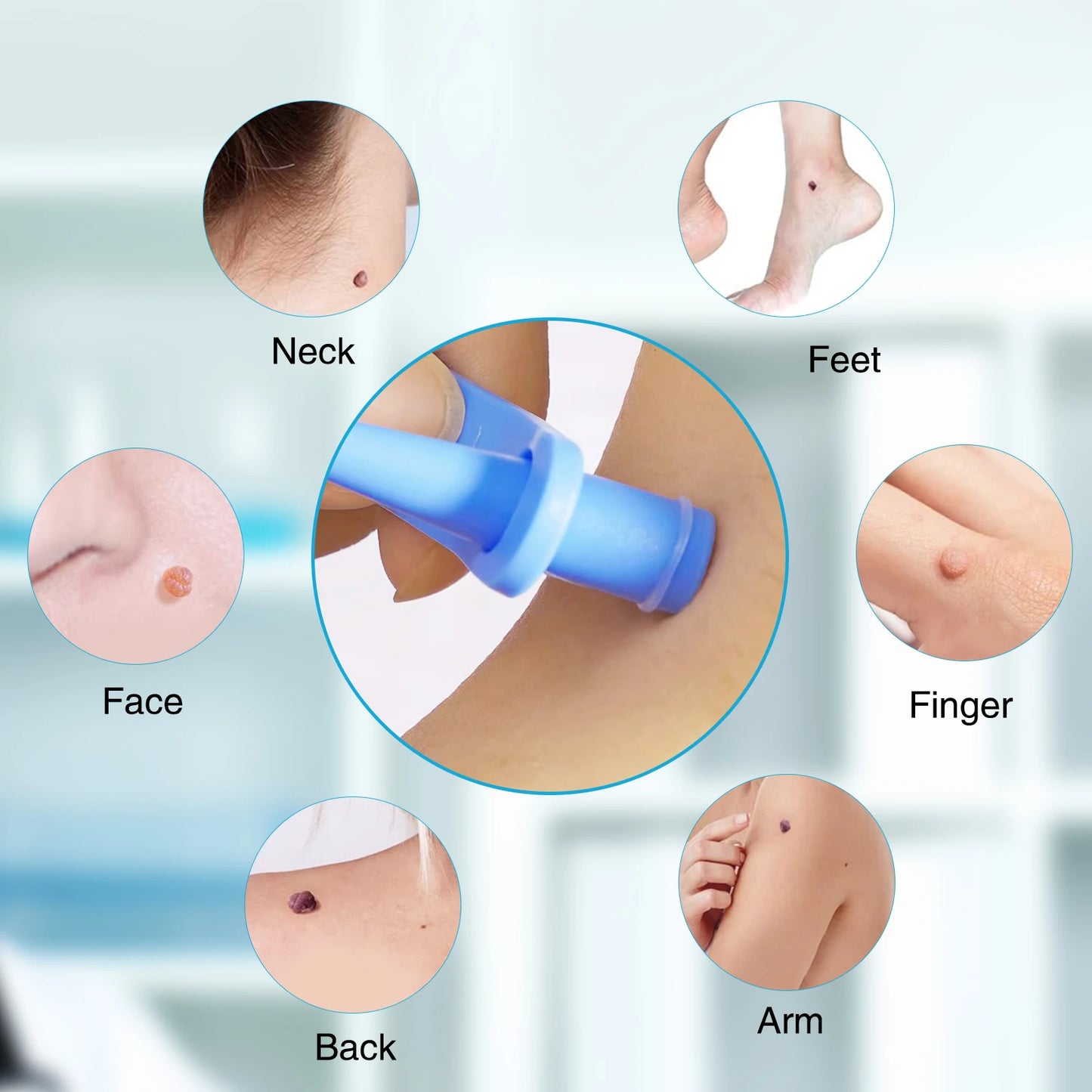 2 IN 1 Auto Micro Skin Tag Remover Device Standard And Micro Skin Tag Removal Kit Adult Mole Wart Remover Face Care Beauty Tools