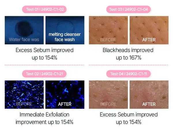 Melting Cleanse Hypoallergenic Makeup remover with Quick Bubble, Deep Pore Cleansing for all skin type, 150ml