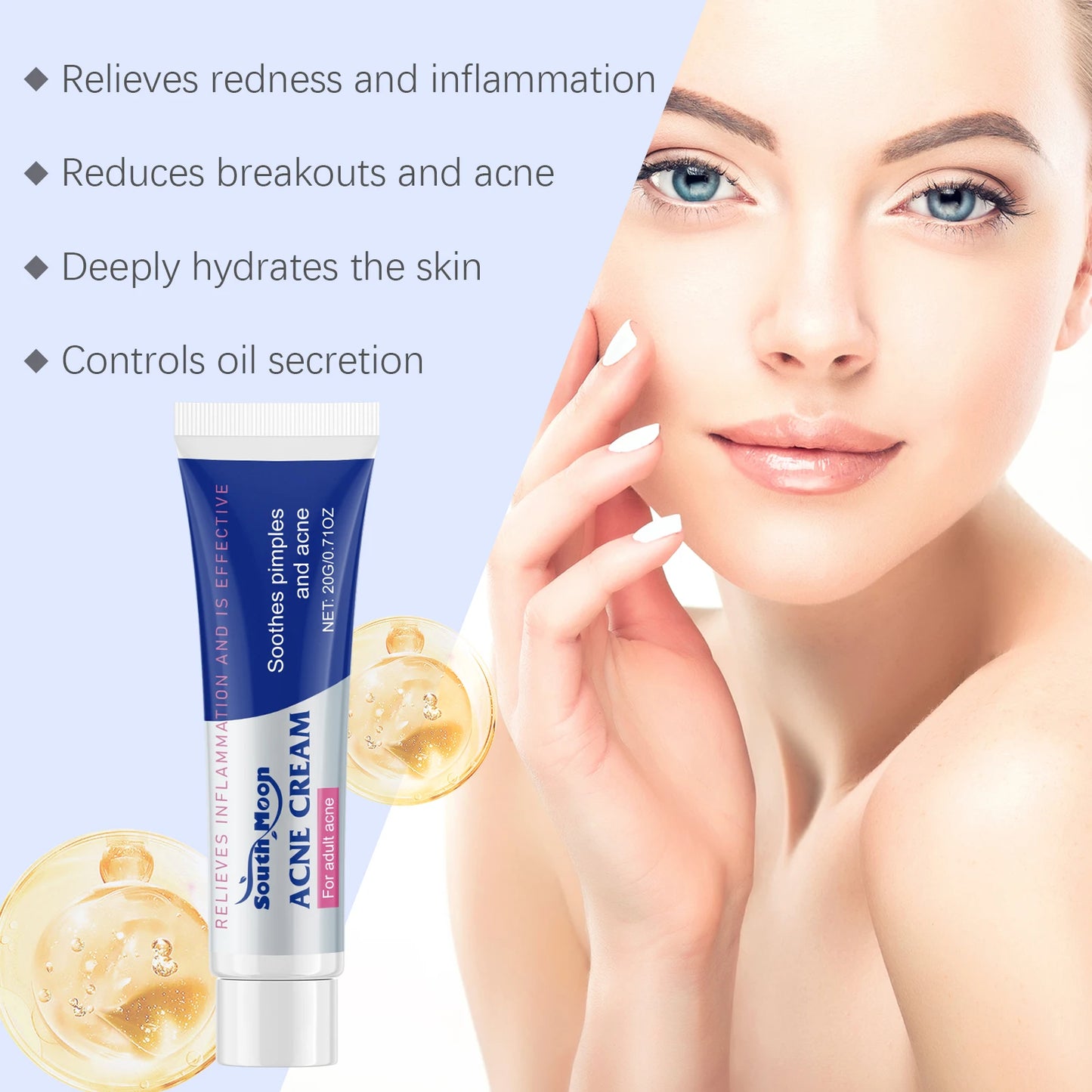 South Moon Anti Acne Cream Oil Control Repair Pimple Spot Remove Acne Mark Cleaning Refreshing Moisturize Skin Pore Shrink Cream