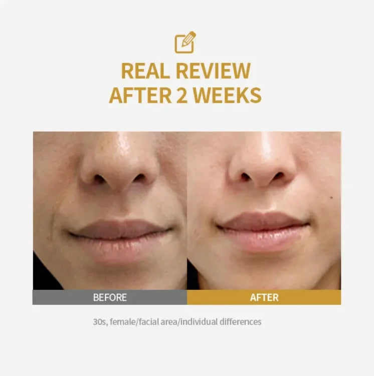 Collagen Peptide Anti-Aging Ampoule | Silk Protein Serum For Skin Tightening & Elasticity Boost