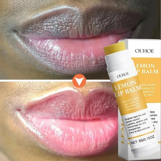 Turmeric Lip Balm for Dark Lips - Moisturizing Treatment