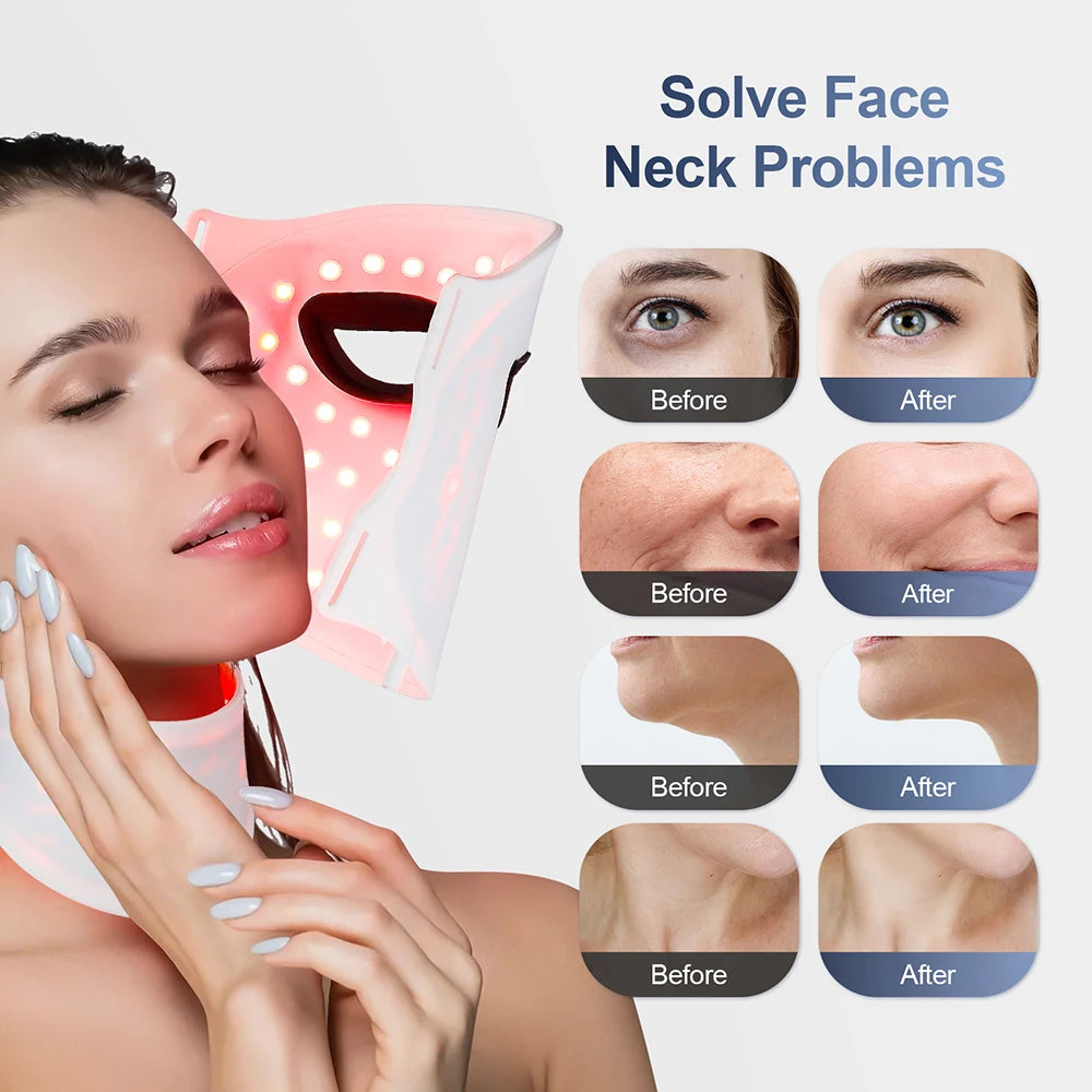 Silicone LED Face & Neck Mask – 7-Color Photon Light Therapy