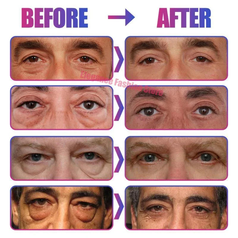 Instant Eye Bag Remove Eye Cream Anti Fat Particles Dark Circles Puffiness Fade Fine Lines Lift Brighten Korean Beauty Eye Care