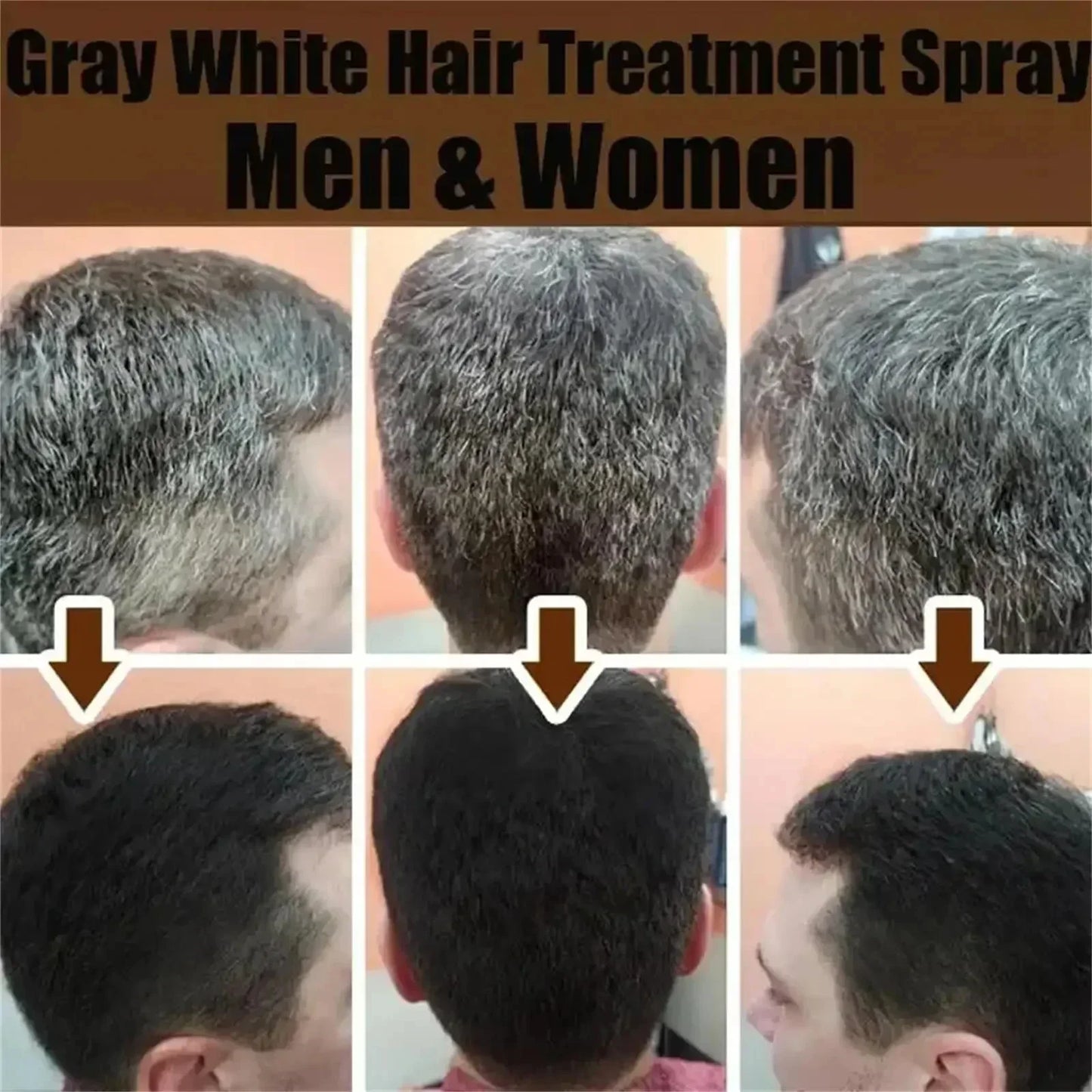 White hair killer, remove gray hair and restore natural hair color in 7 days