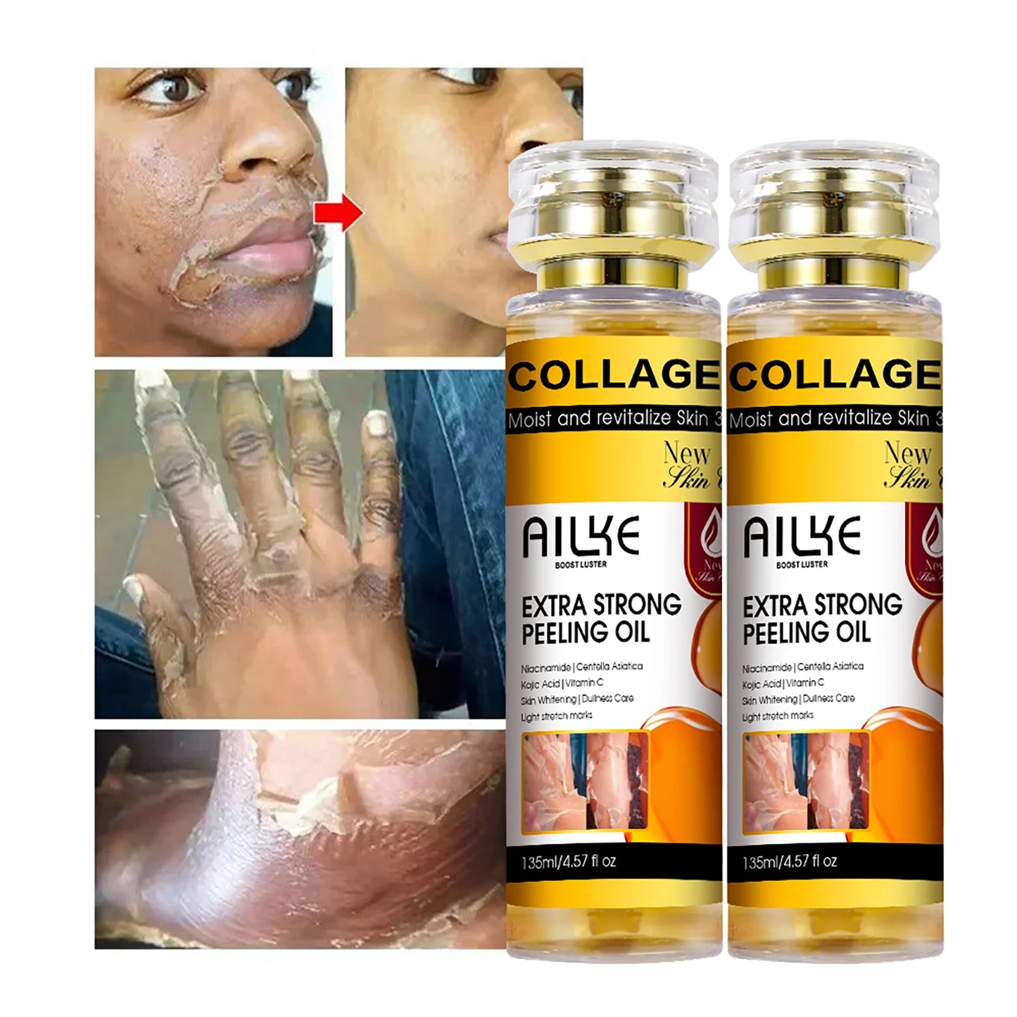 AILKE Collagen & Kojic Acid Peeling Oil 135ml – Whitening, Exfoliating & Brightening for Face, Body, Hands & Feet | All Skin Types