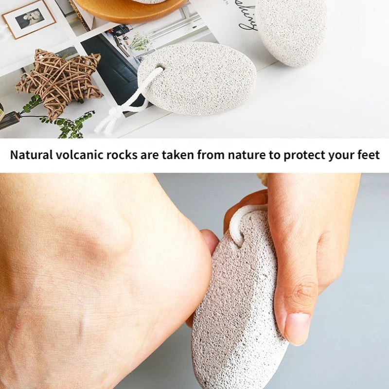 Natural Pumice Stone | Foot Callus Remover | Dead Skin Pedicure Tool | Smooth Skin | Gentle Exfoliation | Home Foot Carev