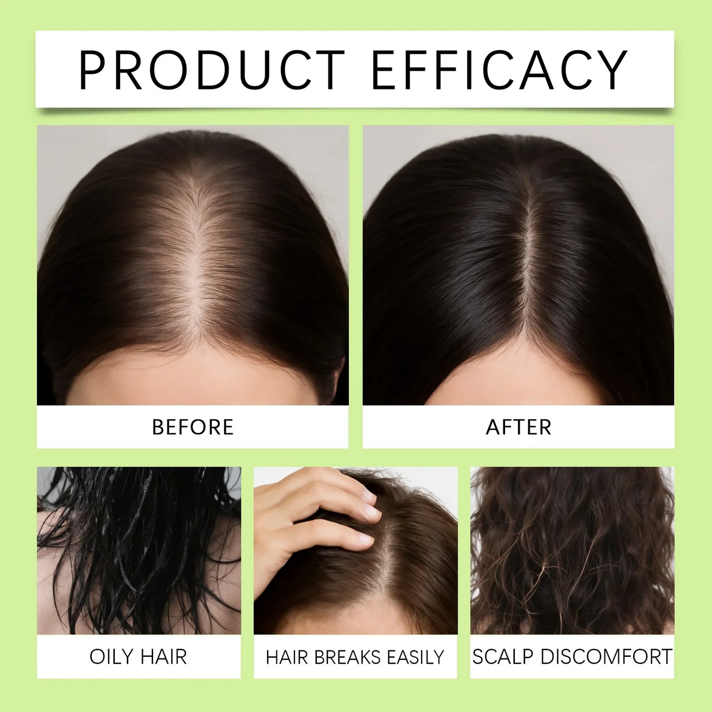 Anti-Hair Loss Scalp Care Roller Serum Kit Nourishes Roots Strengthens Hair Prevents Baldness Daily Care