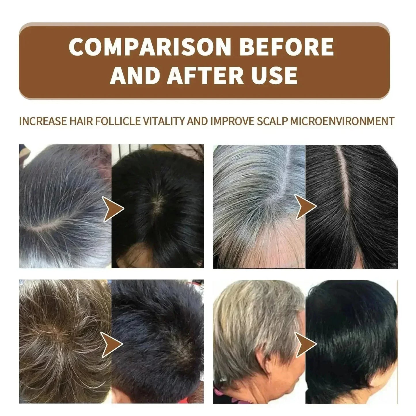 White hair killer, remove gray hair and restore natural hair color in 7 days