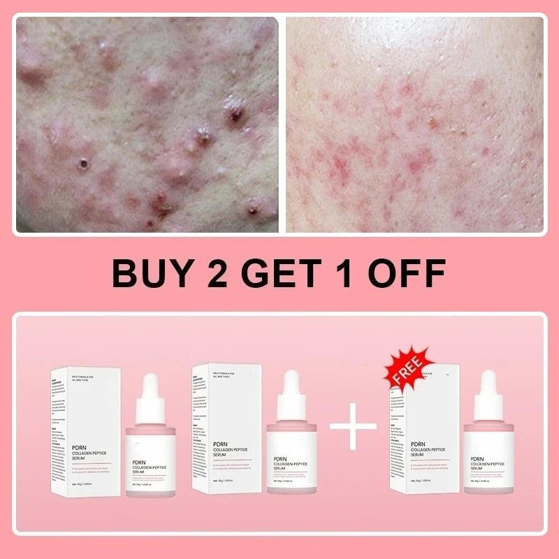 Collagen Peptide Facial Serum for Dull Skin Boosts Elasticity Skin Renewal Repair Salmon PDRN Korean Beauty Product