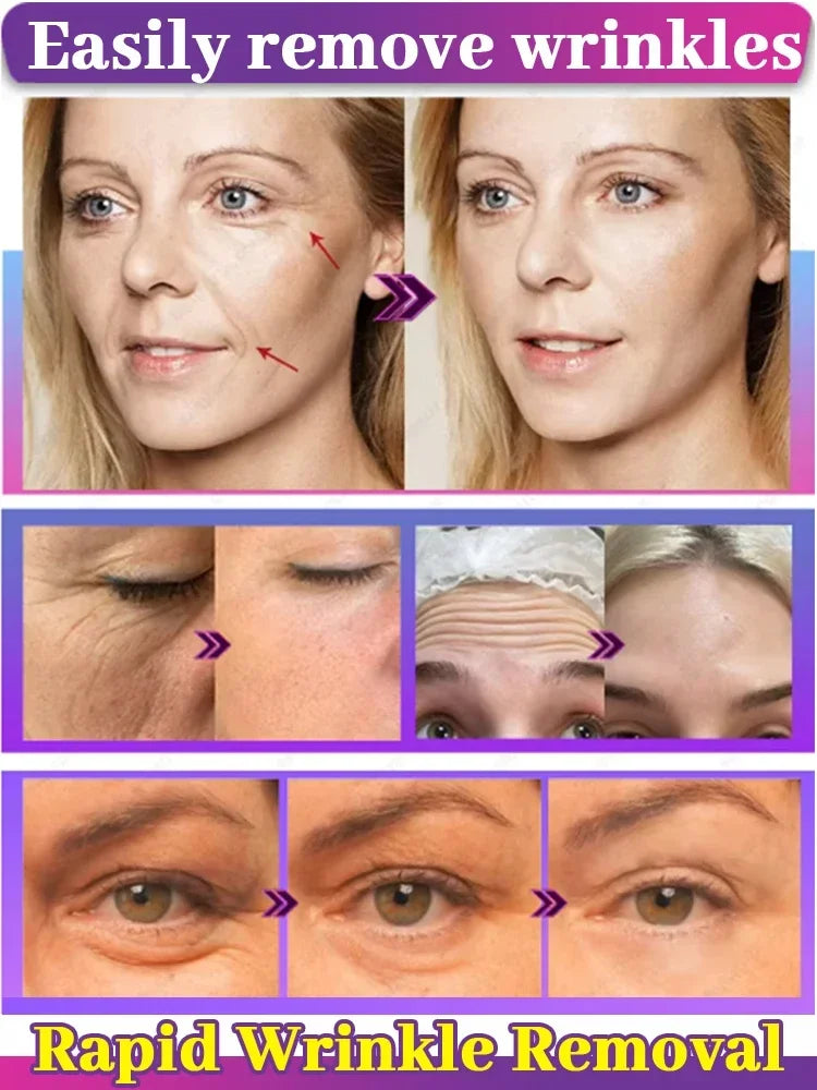 Anti-Aging Instant Wrinkle Smoothing Cream – Look 20 Years Younger | Fine Lines & Firming Face Treatment