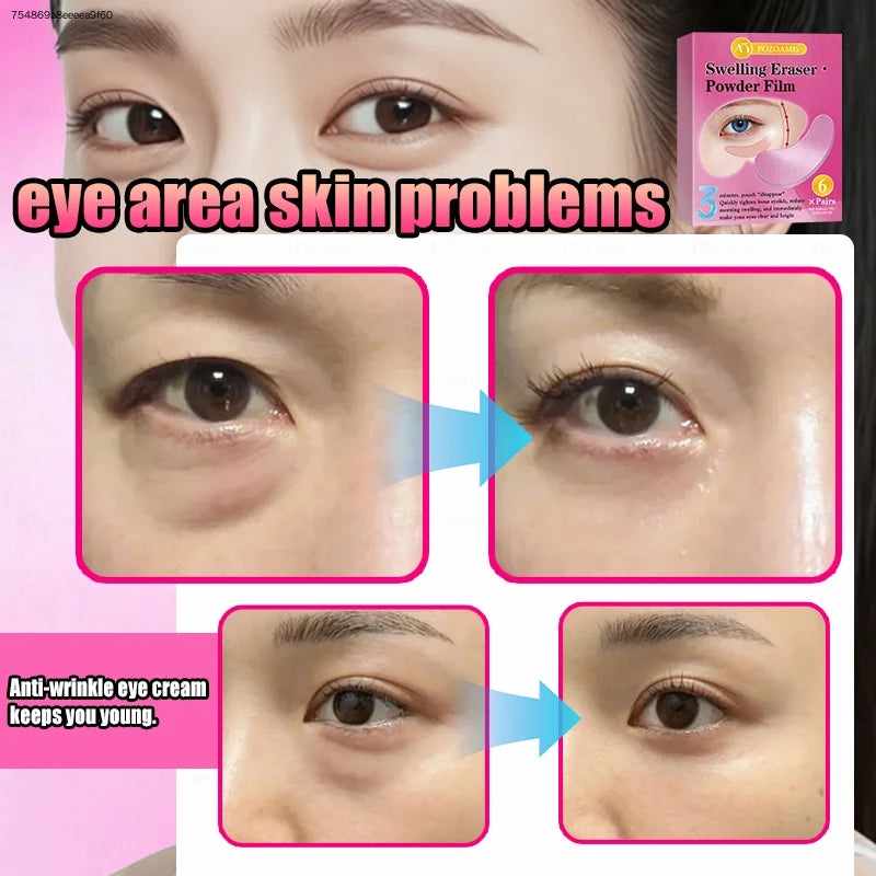 Eye facial mask, eye mask, containing collagen and hyaluronic acid, eye care, eye moisturizing patch, moisturizing eye mask, lift and moisturize skin around eyes, neutral skin